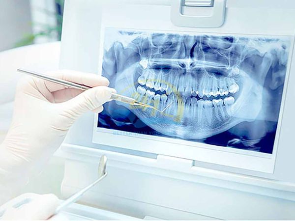 Từ hình ảnh nha khoa giúp bác sĩ chẩn đoán bệnh lý