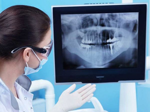 Thiết bị chẩn đoán hình ảnh nha khoa giúp bệnh nhân có trải nghiệm tốt