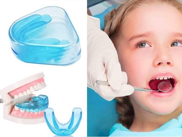 Myobrace giúp điều chỉnh răng của trẻ từ sớm