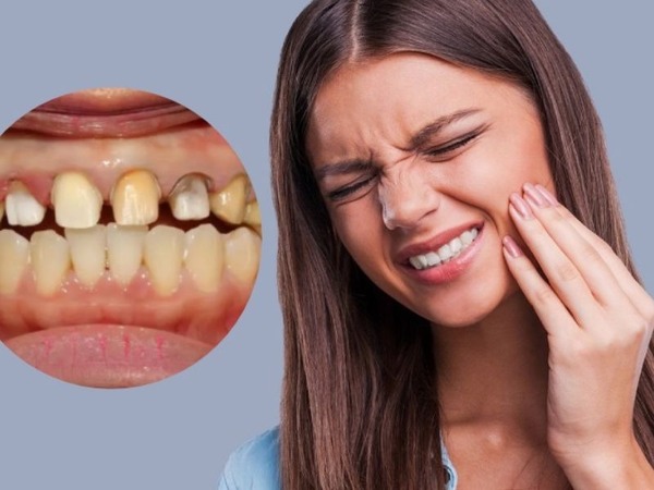 Đau nhức khi bọc răng sứ