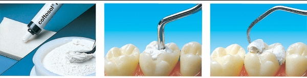 images/2025/tram-rang-tam-thoi-de-lam-gi-1.jpg images/2025/tram-rang-tam-thoi-de-lam-gi-1.jpg