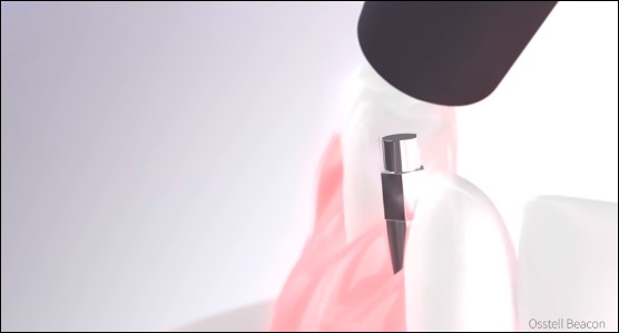 Thiết bị để đo độ ổn định 