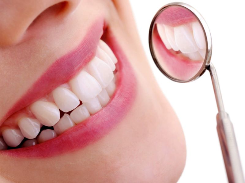 Giải đáp thắc mắc trám răng bằng Composite có bền không Giải đáp thắc mắc trám răng bằng Composite có bền không