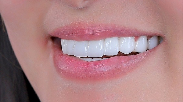 Răng có 3 chức năng chính là nhai, phát âm và thẩm mỹ Răng có 3 chức năng chính là nhai, phát âm và thẩm mỹ