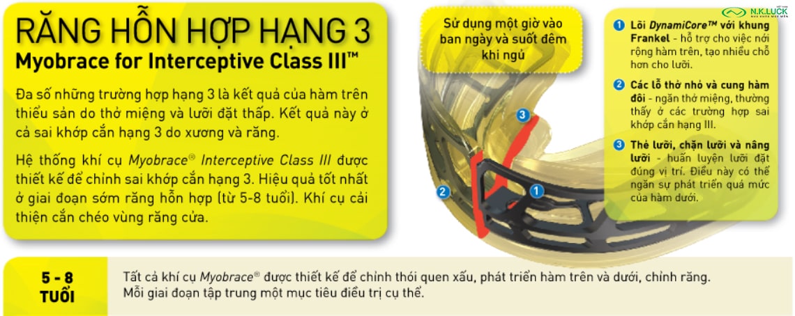 myobrace for interceptive