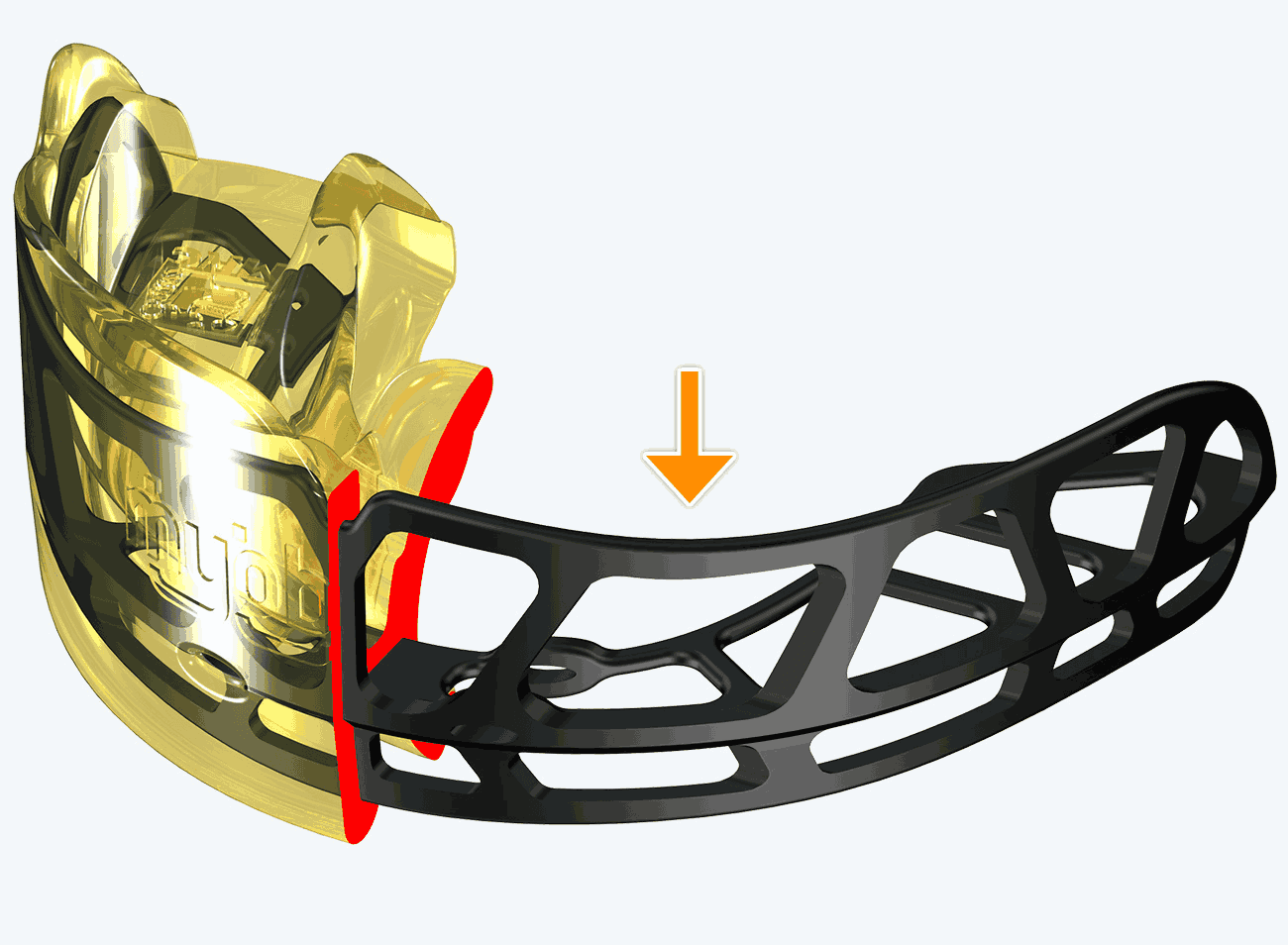 myobrace for interceptive i3R sau