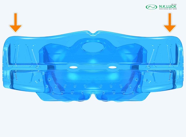 myobrace for junior j1 sau