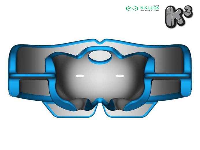 myobrace for kid K3 trước