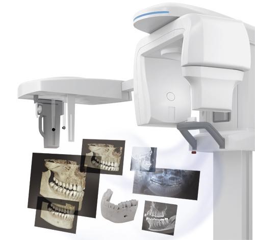 Những lưu ý khi mua thiết bị X Quang toàn cảnh