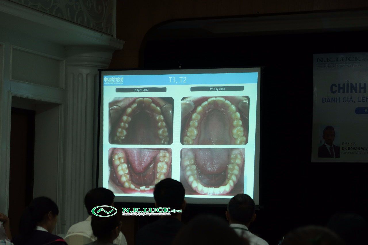 Một số hình ảnh trong Hội thảo về chỉnh nha MRC tại Hà Nội