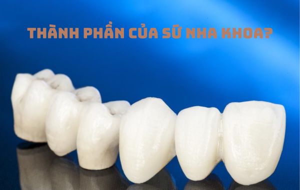 Thành phần của sứ nha khoa gồm những gì? Thành phần của sứ nha khoa gồm những gì?